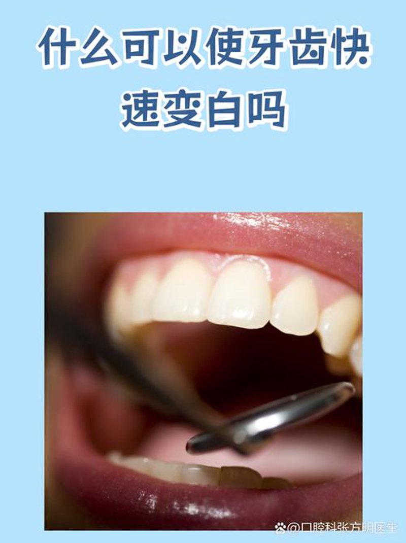 牙齿矫正的常见问答