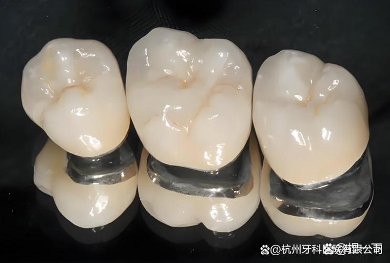 全瓷牙