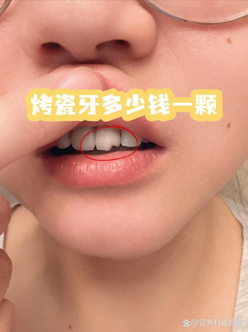 补牙