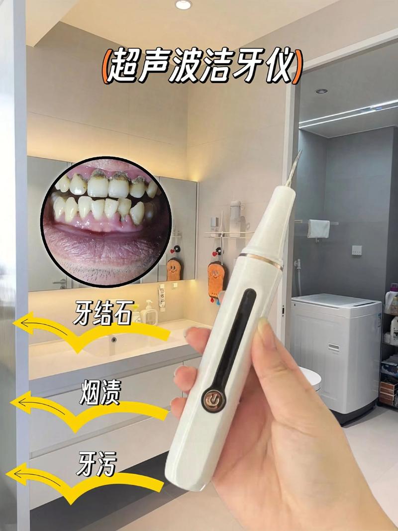 种植牙：重塑口腔健康