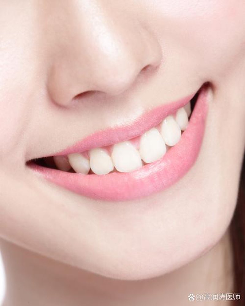 牙周炎治疗